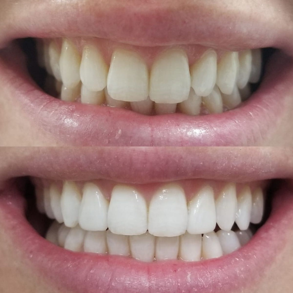 ✨ BioSmile 7™ Dientes + Blanco